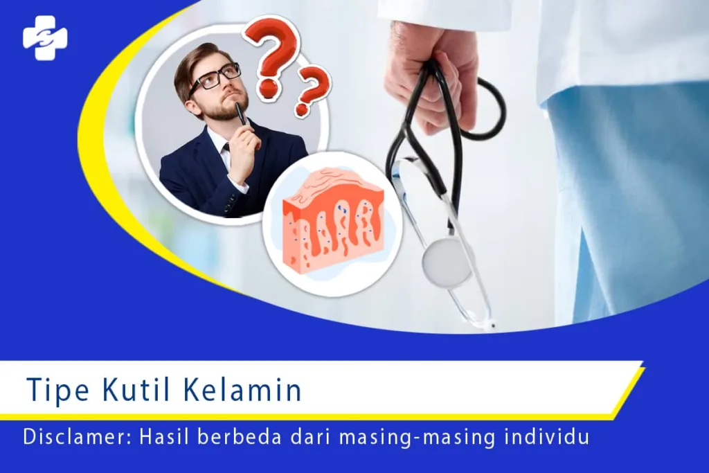 Tipe Kutil Kelamin 1
