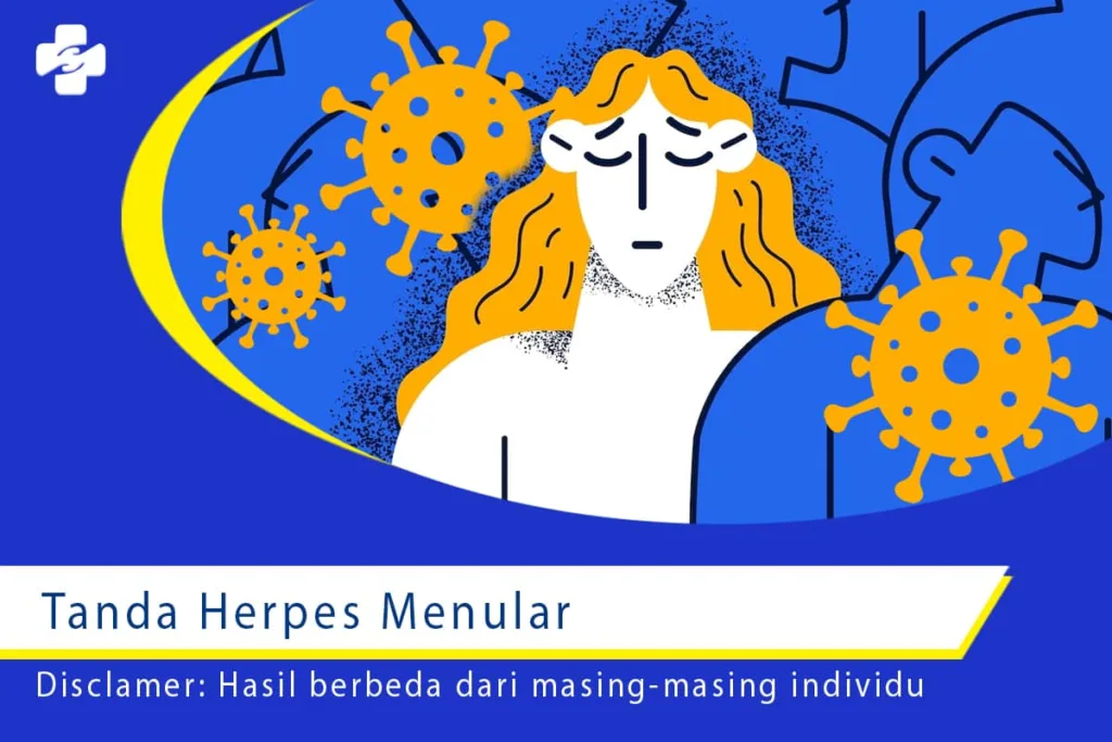 tanda herpes menular