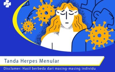 tanda herpes menular