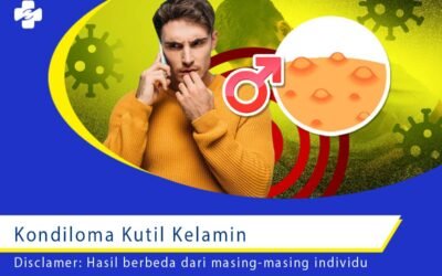 Kondiloma Kutil Kelamin 1
