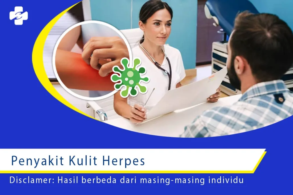 Penyakit Kulit Herpes