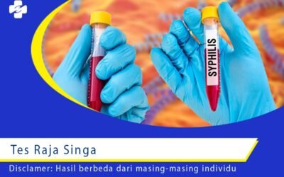 Tes Raja Singa 1