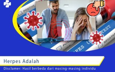 Herpes Adalah Infeksi Viral1