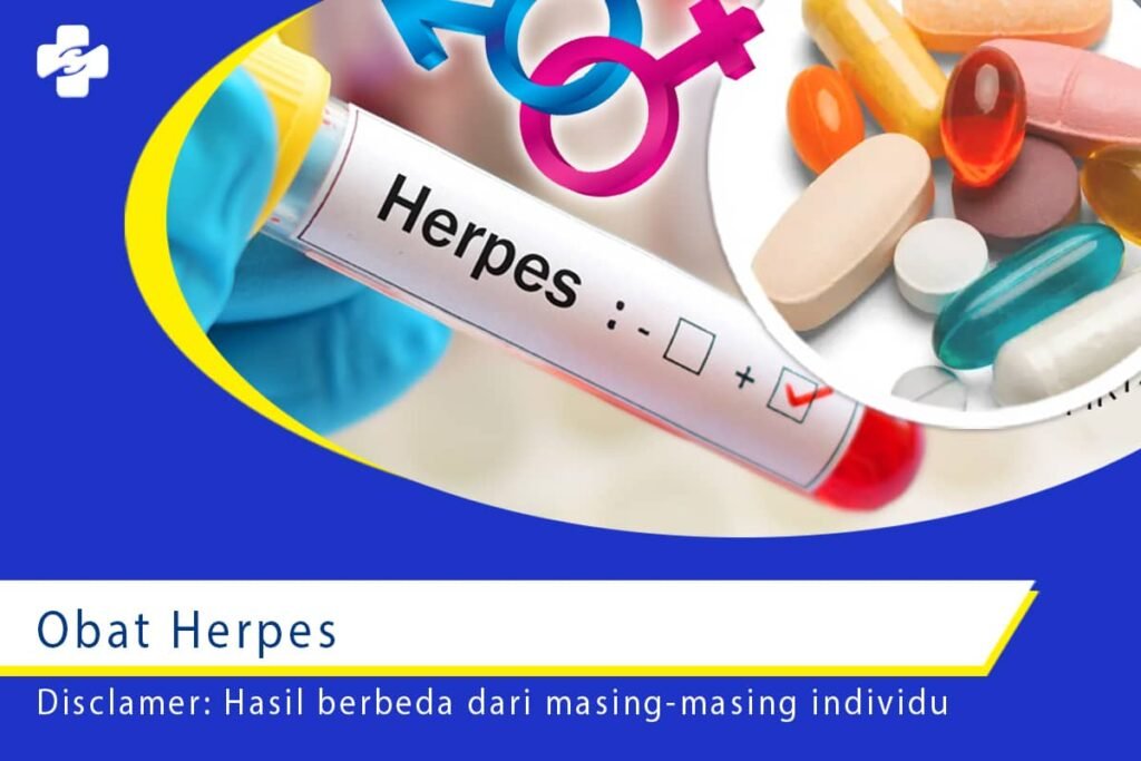 Obat Herpes Apa Saja yang Digunakan?
