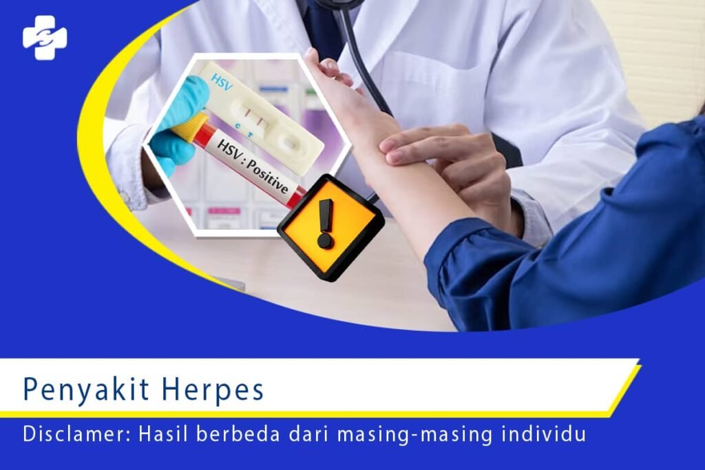 5 Pengaruh Penyakit Herpes pada Kualitas Hidup