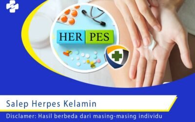 Salep Herpes Kelamin 1