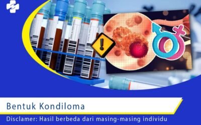 Bentuk kondiloma 1