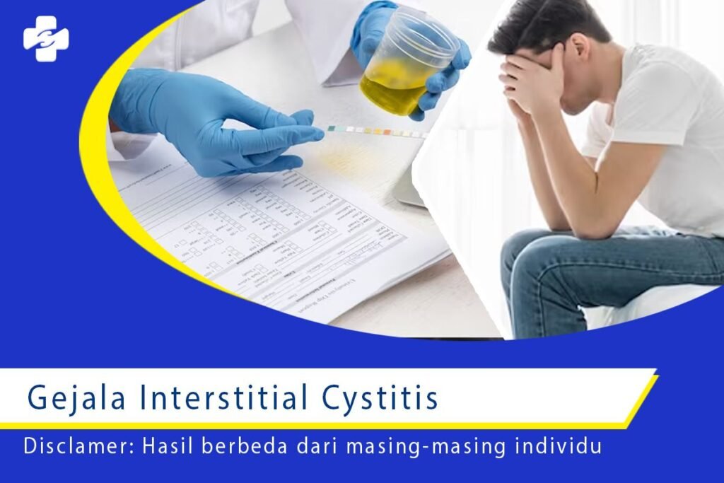 Awas! Gejala Interstitial Cystitis Mungkin Anda Alami