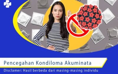 Pencegahan Kondiloma Akuminata 1