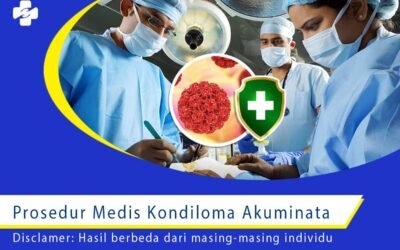 Prosedur Medis Kondiloma Akuminata 1