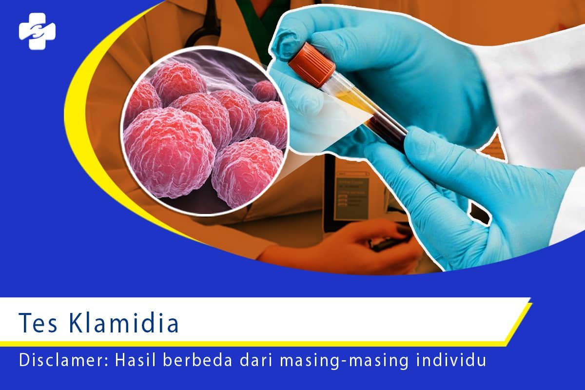 Jenis-jenis Tes Klamidia untuk Lindungi Diri Anda! | Klinik Utama Apollo
