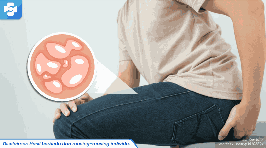 lepuh herpes kambuh 2_6_11zon