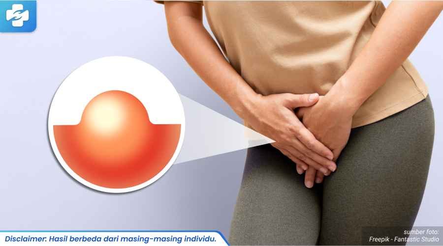 benjolan bernanah di vagina 2_6_11zon