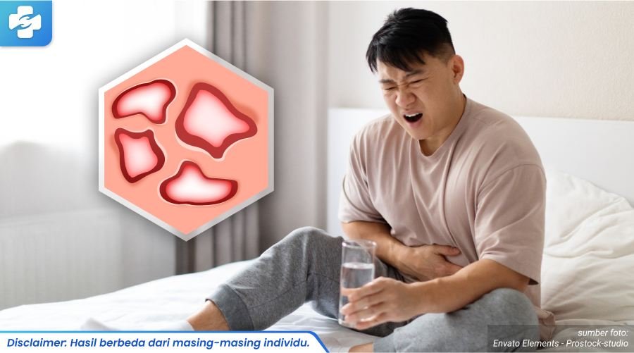 obat penyakit raja singa 2_4_11zon