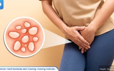 tanda herpes kelamin parah 1_1_11zon