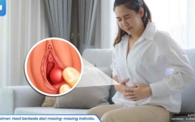 obat kista bartholin 1_3_11zon