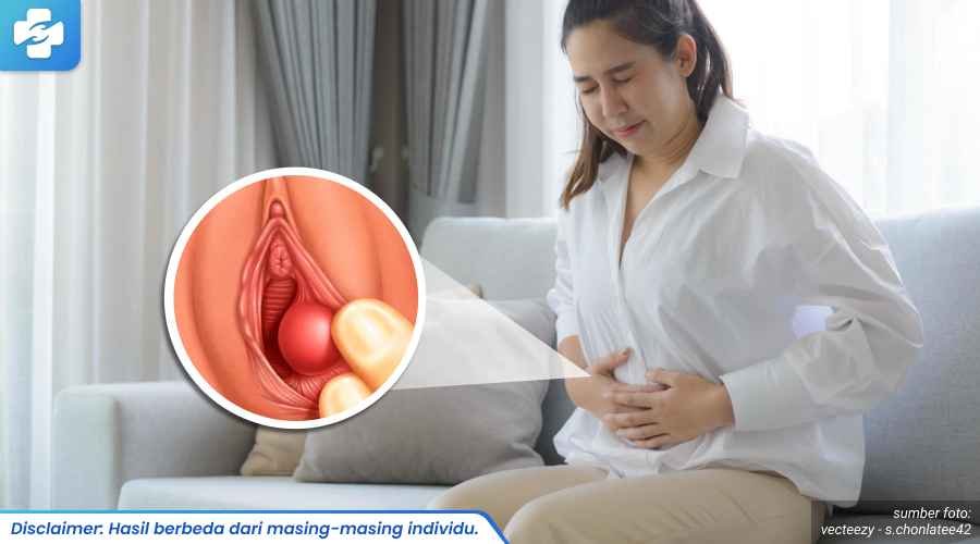 obat kista bartholin 1_3_11zon