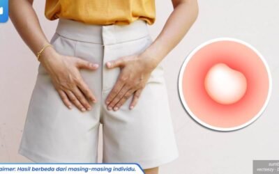 benjolan kecil di vagina 1_6_11zon