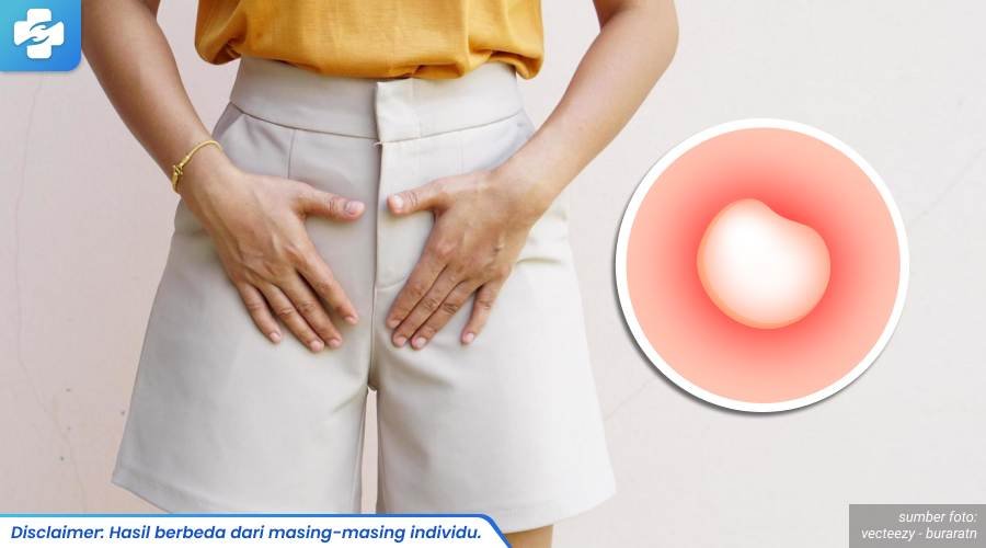 benjolan kecil di vagina 1_6_11zon