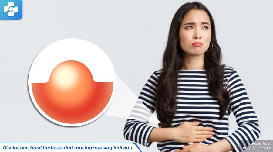kista bartholin pecah keluar darah 1_6_11zon
