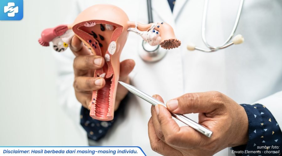 gejala kista di vagina 2_6_11zon