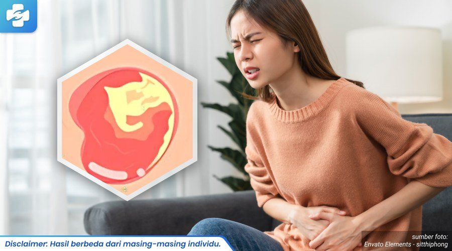 komplikasi infeksi gonore 1_7_11zon