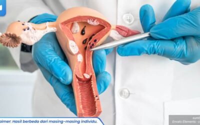 kutil kelamin parah 1_3_11zon