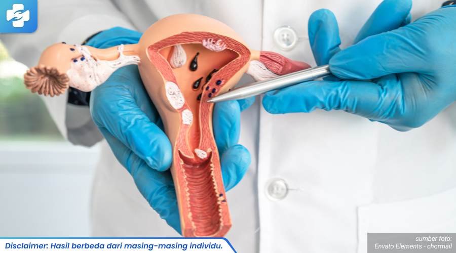 kutil kelamin parah 1_3_11zon