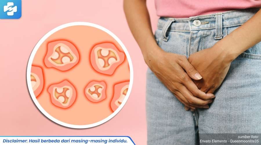 selangkangan sering gatal 1_4_11zon