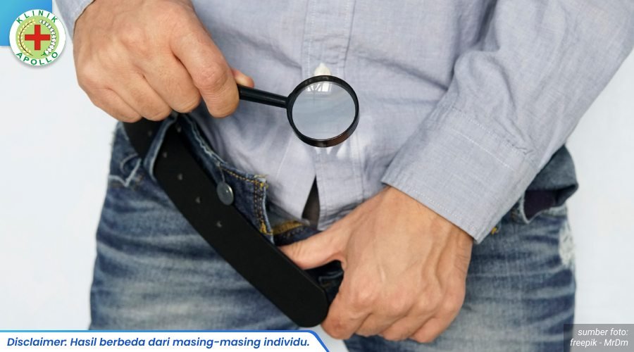 cara mengatasi impotensi 1_1_11zon