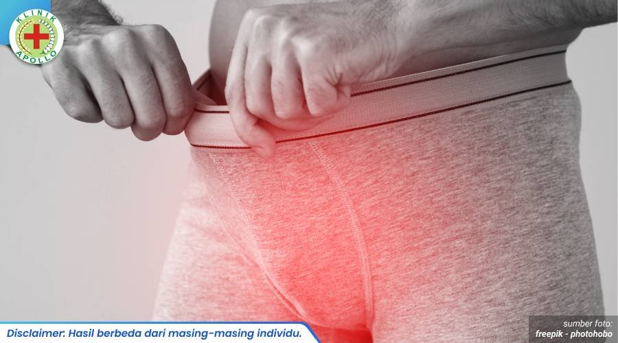 gejala fimosis 1_2_11zon