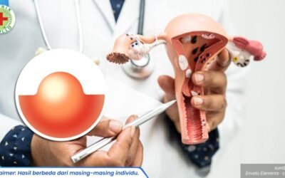 infeksi bibir vagina 1_1_11zon