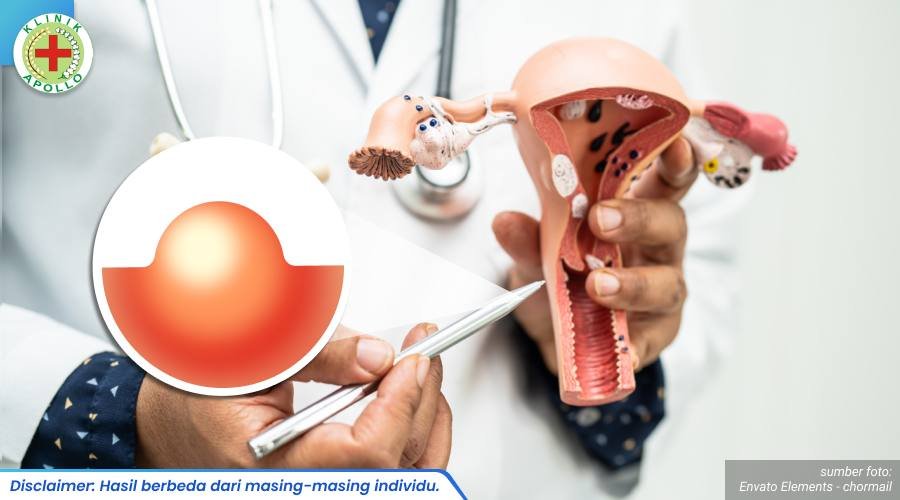 infeksi bibir vagina 1_1_11zon