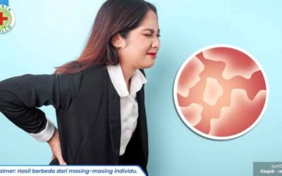 infeksi jamur kelamin berulang 1_2_11zon