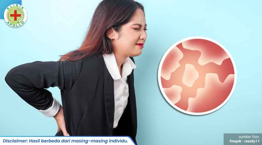 infeksi jamur kelamin berulang 1_2_11zon