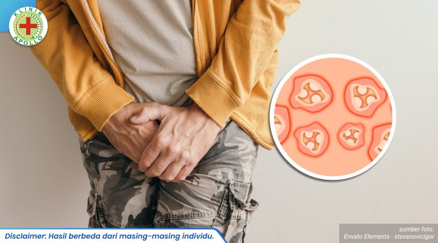 klinik pengobatan sifilis 2_4_11zon