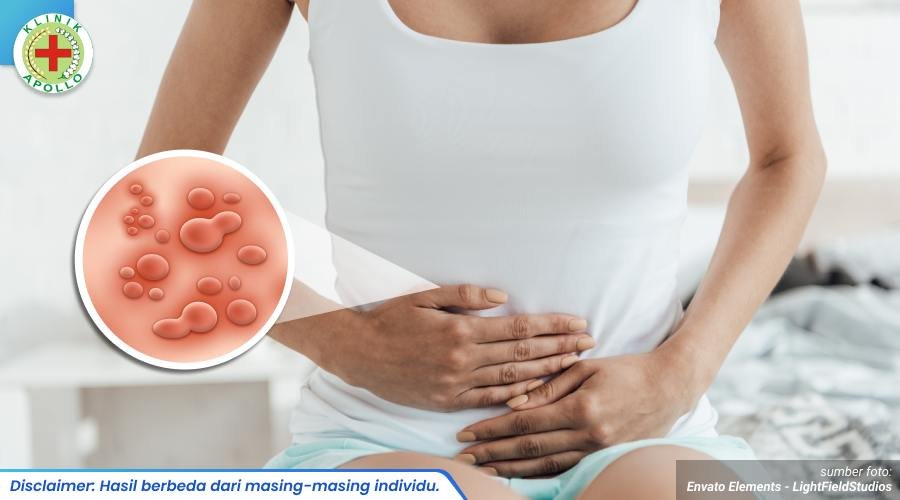 kutil hpv di kelamin 1_3_11zon