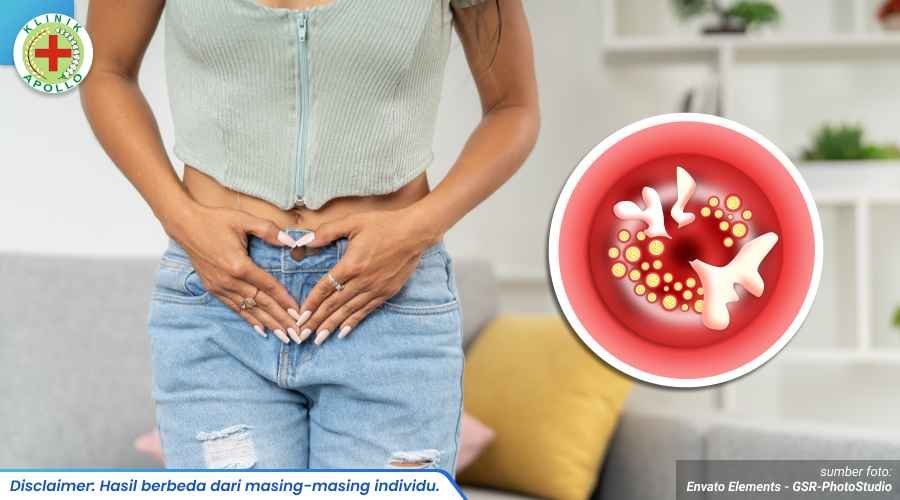 radang leher rahim 1_3_11zon