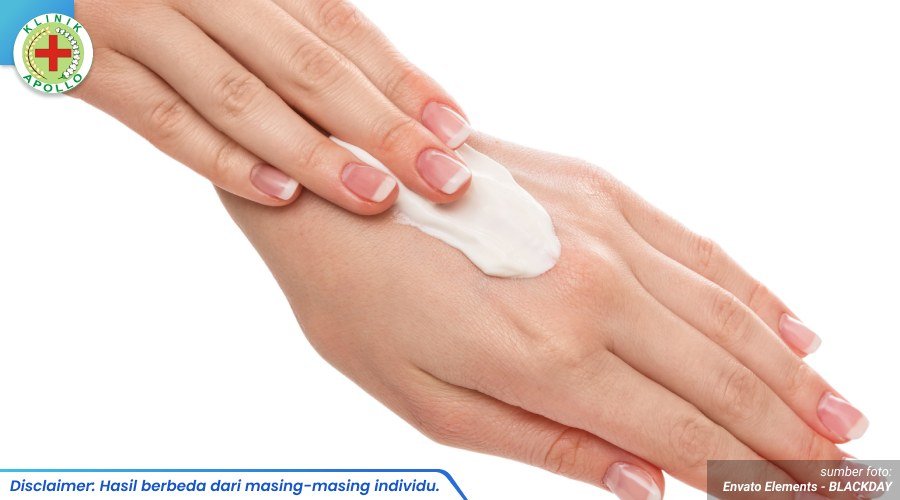 keputihan karena bakteri 1_1_11zon