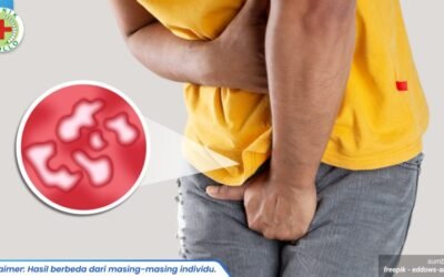 penyakit raja singa 1_1_11zon