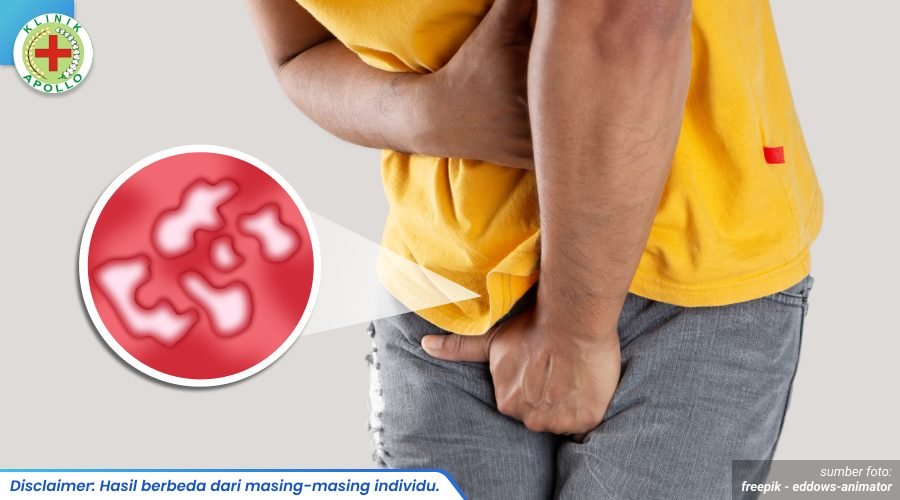 penyakit raja singa 1_1_11zon