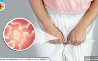 selangkangan berjamur 1_5_11zon