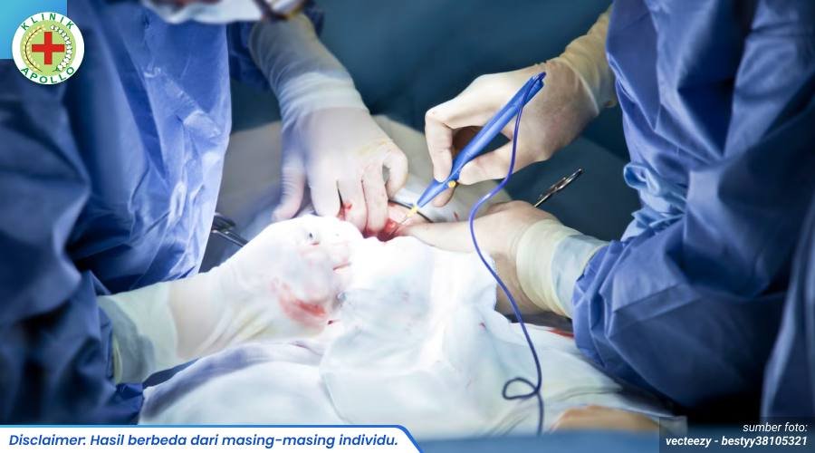 cara hilangkan kutil kelamin 1_1_11zon