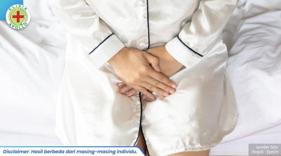 cara membersihkan kutil kelamin 2