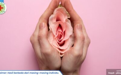 gatal pada selangkangan wanita 1