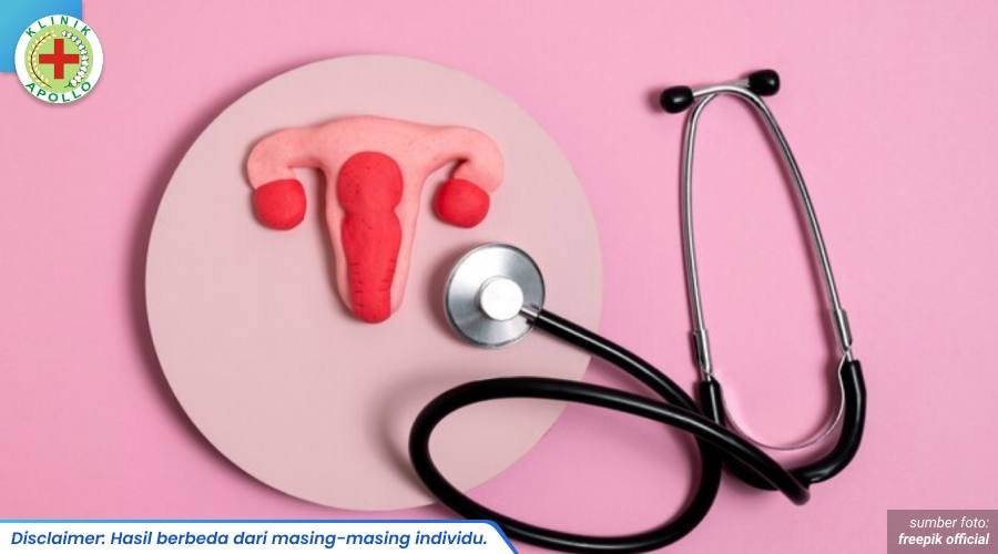 kandidiasis vagina 1_5_11zon