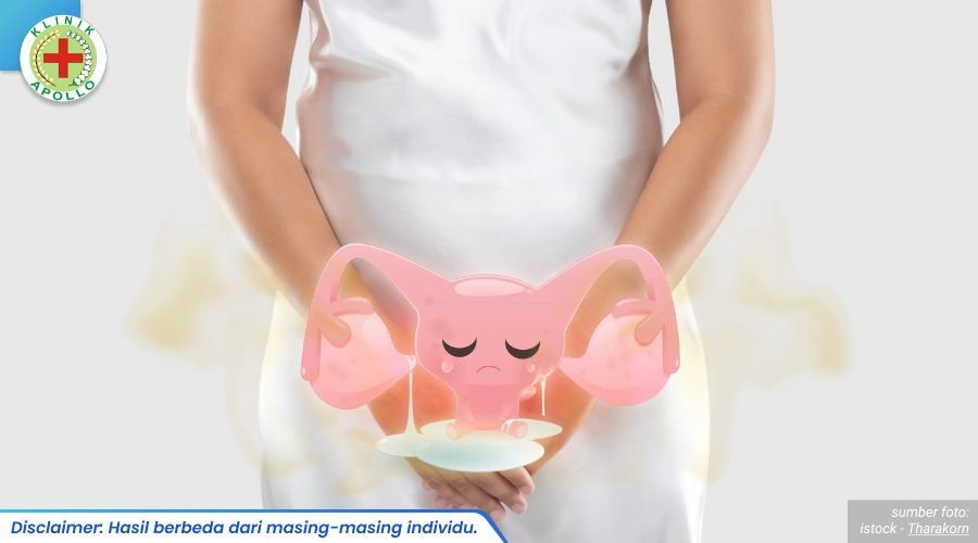 kelamin wanita bernanah 2 - blog.sentosaklinik.com_6_11zon