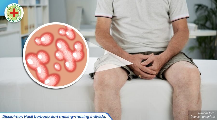kutil di kelamin pria 2_3_11zon
