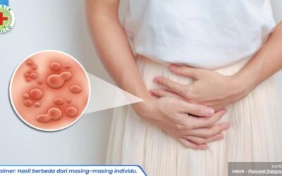 luka lecet pada kemaluan wanita 1 - blog.sentosaklinik.com_2_11zon