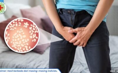 keluar cairan putih di penis 1_2_11zon